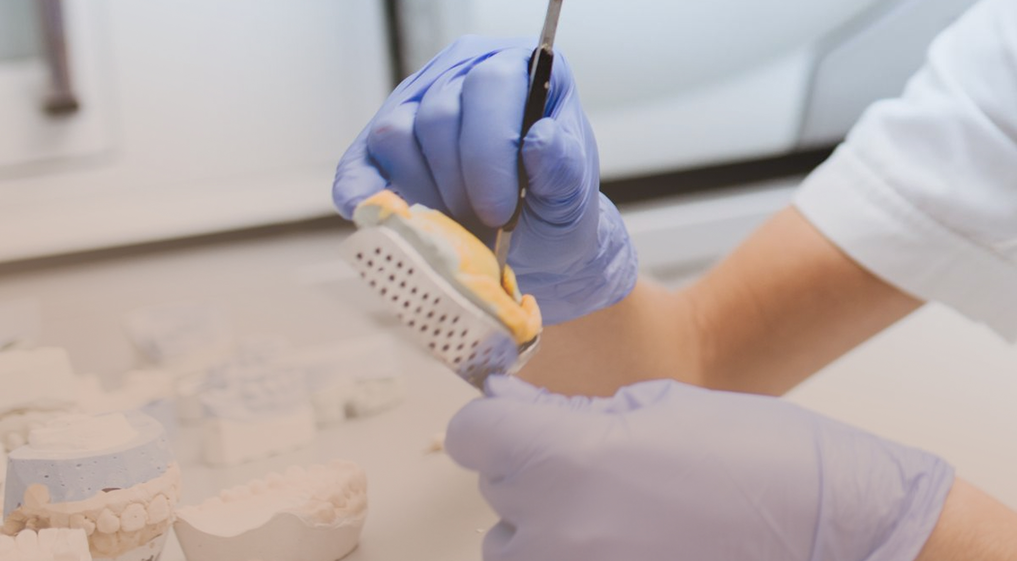 dantų protezavimas odontologijos klinikoje